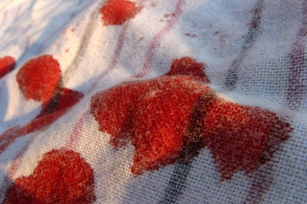 Quick Tip: How to Remove Blood Stains